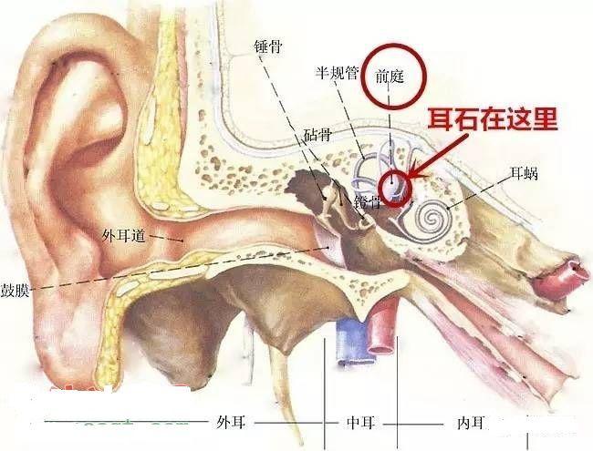 耳石症是什么原因引起的啊